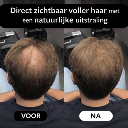 THICKR - Haarlijn Poeder